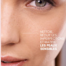 Kit no spot peaux sensibles enoliss