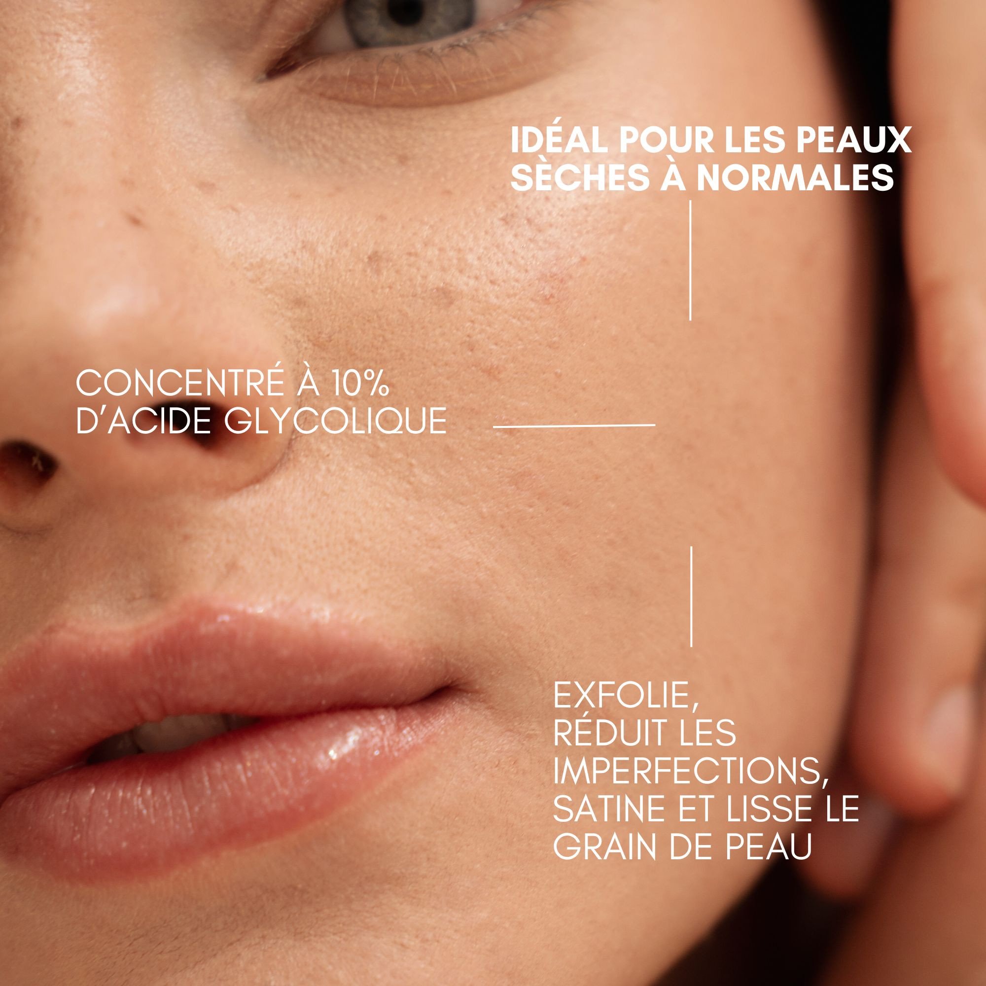 Perfect Skin 10 AHA bénéfices pour la peau-Image2