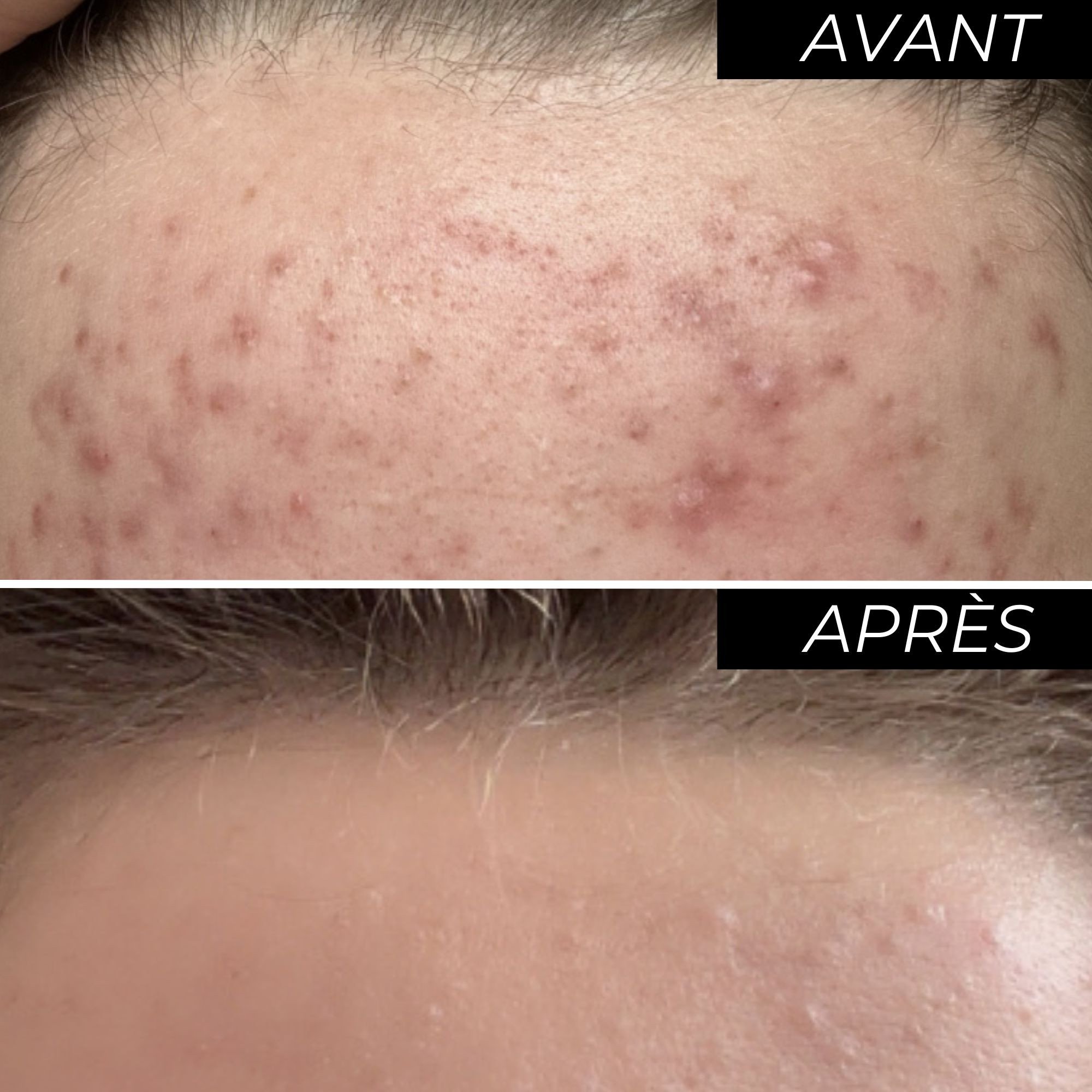 Enoliss Perfect Skin 15 AHA-Image4
