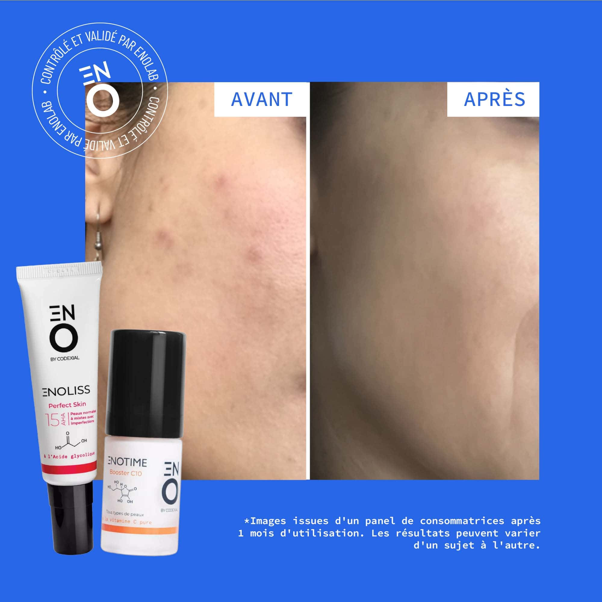 Photos avant / après résultats-Image8